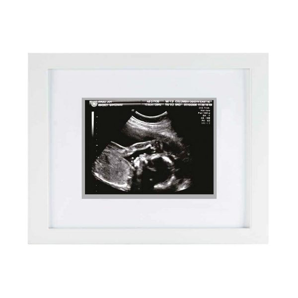 Sonogram Frame